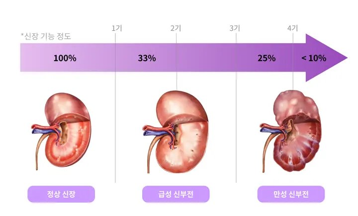 고양이 신부전 IRIS 단계와 크레아티닌 검사 수치
